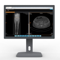 Монитор для использования в медицине DT-240 (DICOM)